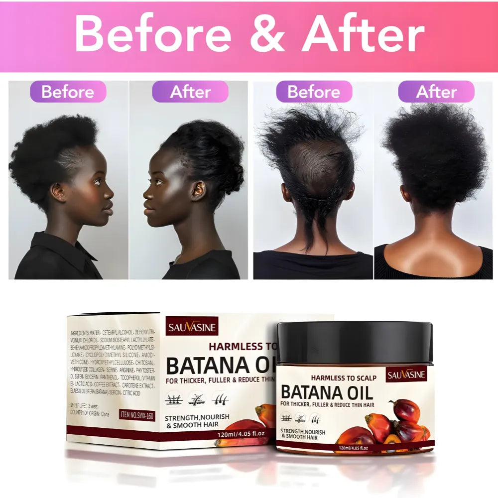 Aceite de Batana Natural de Honduras 120ml | Acondicionador Reparador para Crecimiento Capilar, Brillo y Suavidad | Aroma a Café