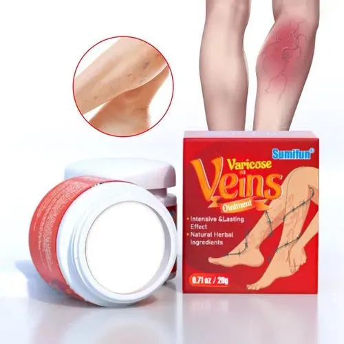 Kit 2x1 Crema para Várices y Arañitas | Alivio de Pesadez, Mejora la Circulación y Reduce Inflamación - Fórmula Botánica Natural