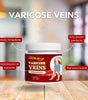 Kit 2x1 Crema para Várices y Arañitas | Alivio de Pesadez, Mejora la Circulación y Reduce Inflamación - Fórmula Botánica Natural