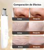 Limpiador Facial Ultrasónico Pro | Espátula de Peeling para Puntos Negros y Limpieza de Poros | Tecnología 24K Hz | Regenerador de Colágeno Recargable