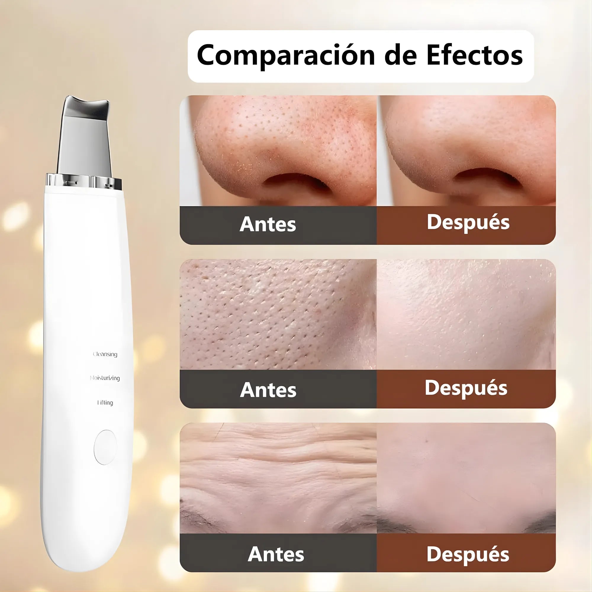 Limpiador Facial Ultrasónico Pro | Espátula de Peeling para Puntos Negros y Limpieza de Poros | Tecnología 24K Hz | Regenerador de Colágeno Recargable