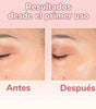 Serum Facial 4 en 1 Nexiora | Vitamina C, Ácido Hialurónico, Vitamina E y Niacinamida | Antiarrugas, Antimanchas e Iluminador Pro